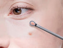 Kit de 4 Ferramentas de Beleza Extrator de Acne Removedor de Cravo Espinha Aço Inoxidável